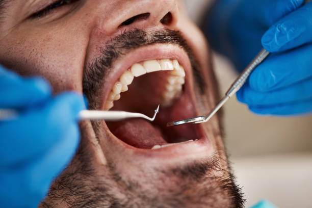 Best Dentist for Tooth Abscess  in Kutztown University, PA